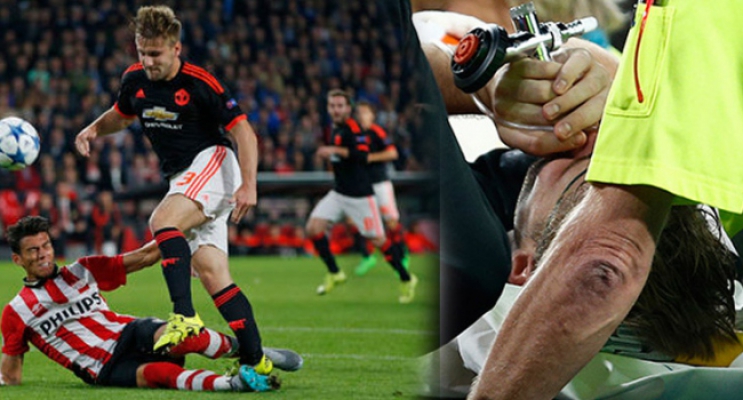 Luke Shaw ayağı kırıldı